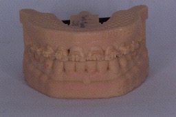Modelo dental MOdelos dentales articulados